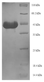 SDS-PAGE