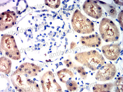 Валидация AntibodySystem RHJ47001