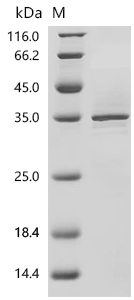 SDS-PAGE