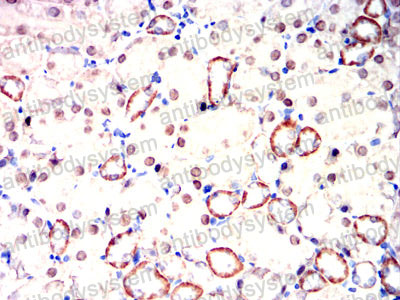 Валидация AntibodySystem RHE14901 (1998)