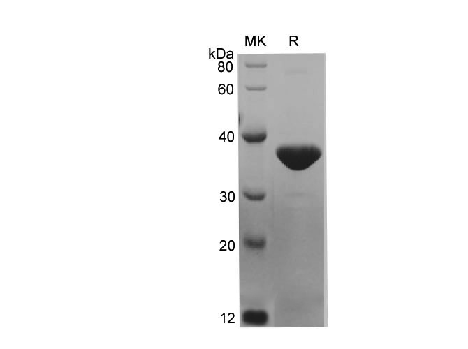Валидация Elabscience PDEM100221(555)