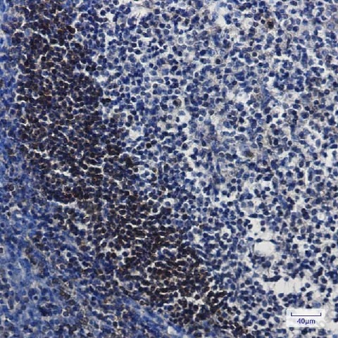 Иммуногистохимия, Leukotriene A4 hydrolase, ткань миндалин человека