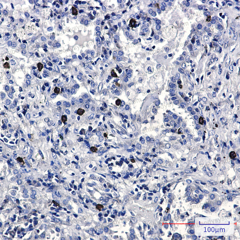 Валидация AntibodySystem RHF87801