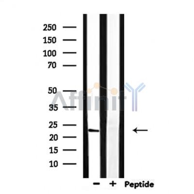 Валидация Affinity DF9813 - 22690