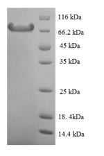 SDS-PAGE