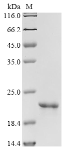 SDS-PAGE