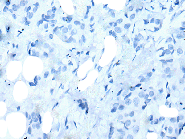 Валидация AssayVector ARM1957(2823)