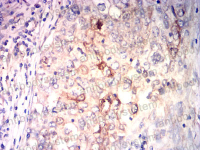 Валидация AntibodySystem RHF15802 (2474)