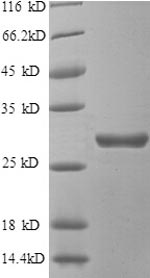 SDS-PAGE