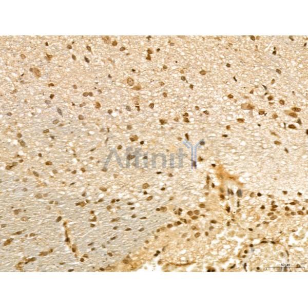 Валидация Affinity DF13127 - 8051