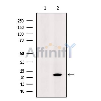 Валидация Affinity DF8302 - 20151