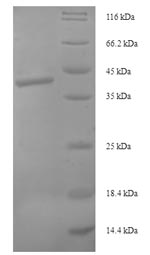 SDS-PAGE