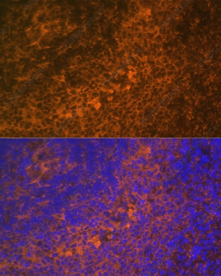 Иммунофлуоресценция, TNFRSF10A, ткань селезенки крысы