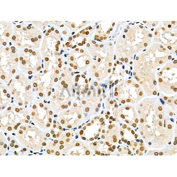 Валидация Affinity DF6926 - 18529