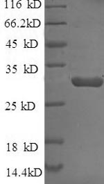 SDS-PAGE