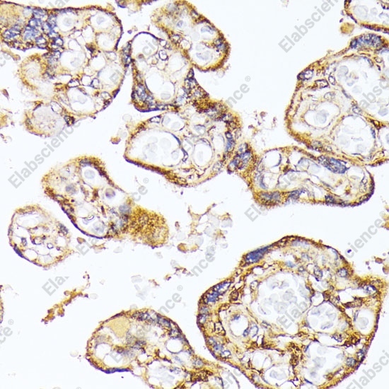 Иммуногистохимия, VEGF Receptor 1, ткань плаценты человека