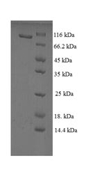 SDS-PAGE