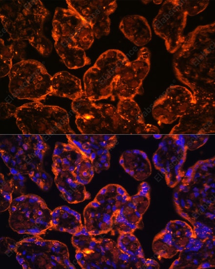 Иммунофлуоресценция, ENTPD1/CD39, ткань плаценты человека