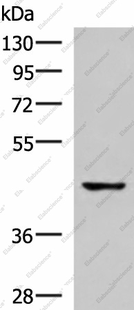 Вестерн-блоттинг, TNFRSF10D, клетки 293T