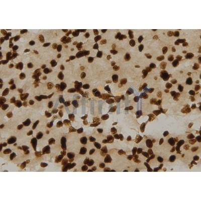 Валидация Affinity DF6278 - 17581