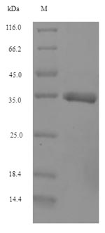 SDS-PAGE