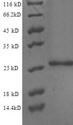 SDS-PAGE
