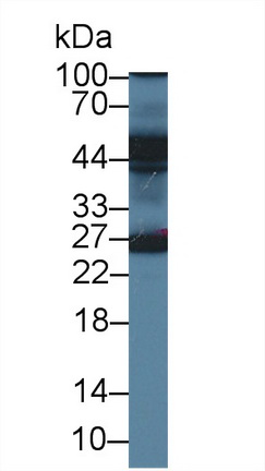 14023