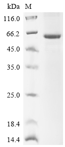 SDS-PAGE
