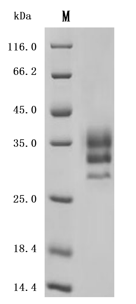 SDS-PAGE