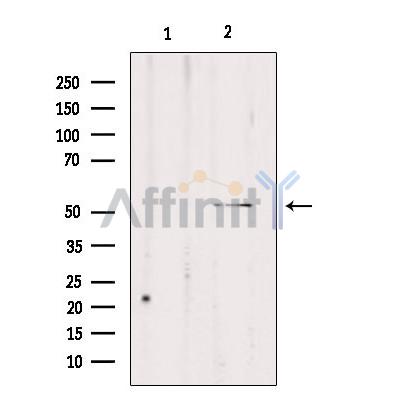 Валидация Affinity DF3898 - 15065