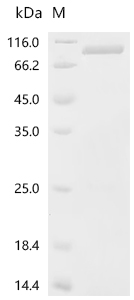 SDS-PAGE