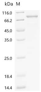 SDS-PAGE
