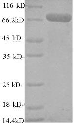 SDS-PAGE