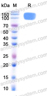 AHD74101, SDS-PAGE