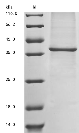 SDS-PAGE