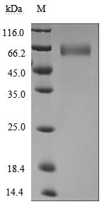 SDS-PAGE