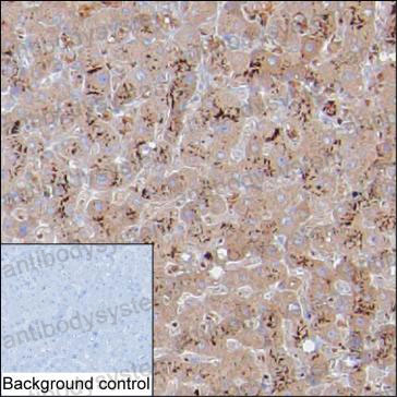 Валидация AntibodySystem RHB14202