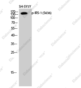 Вестерн-блоттинг, Phospho-IRS1 (Ser636), клетки SH-SY5Y