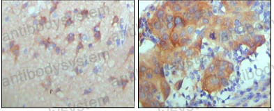 Валидация AntibodySystem RHD48404