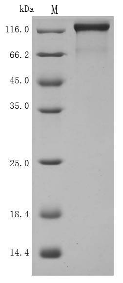 SDS-PAGE