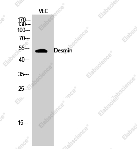 Вестерн-блоттинг, Desmin, клетки VEC