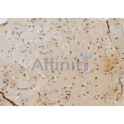 Валидация Affinity DF6074 - 17285