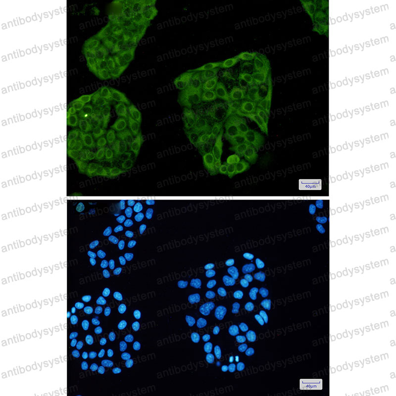 Валидация IF - AntibodySystem RHC30304