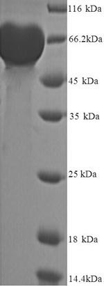 SDS-PAGE
