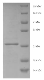 SDS-PAGE