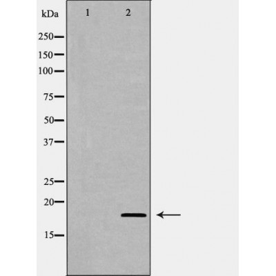 Валидация Affinity DF6669 - 18154