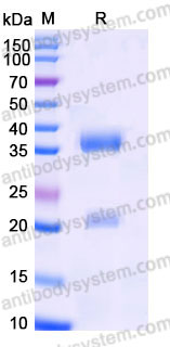 EHB92503, SDS-PAGE
