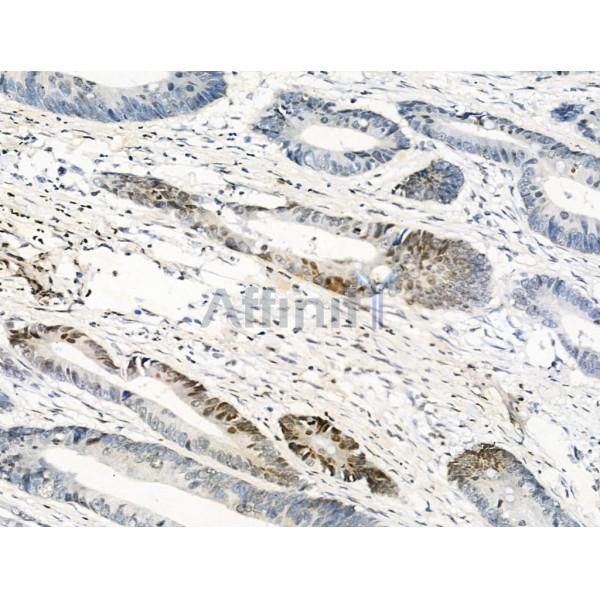 Валидация Affinity AF3957 - 2087