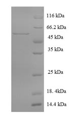 SDS-PAGE