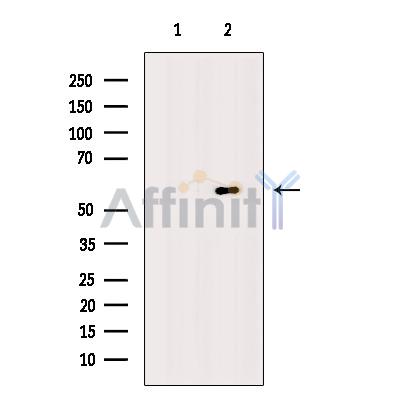 Валидация Affinity DF10315 - 5936